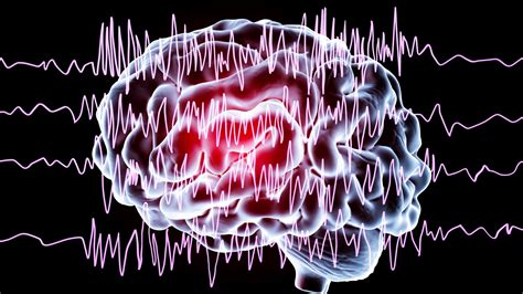 Epilepsy Seizure Disorder