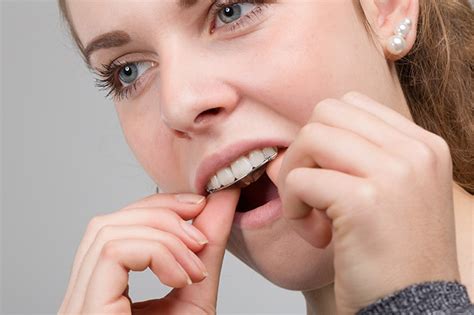 This system is made to keep your retainers free of odor, hygienic and clear, but removing plaque in just 15 minutes. Lifetime Retainer Wear | My Smile CT New Canaan CT 06840