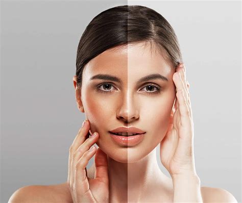 How Ipl Photofacial Treatment Safely Treats Skin Problems