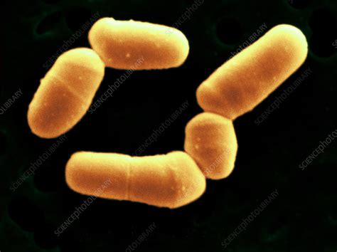 Bifidobacterium Bifidum Stock Image B2201563 Science Photo Library