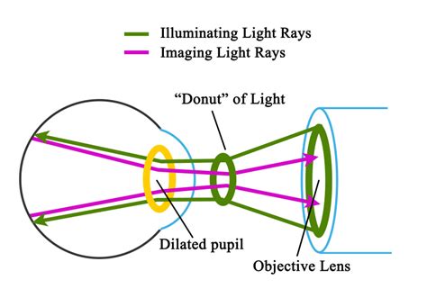 Figure Illumination And Imaging Of The Retina Through The Pupil