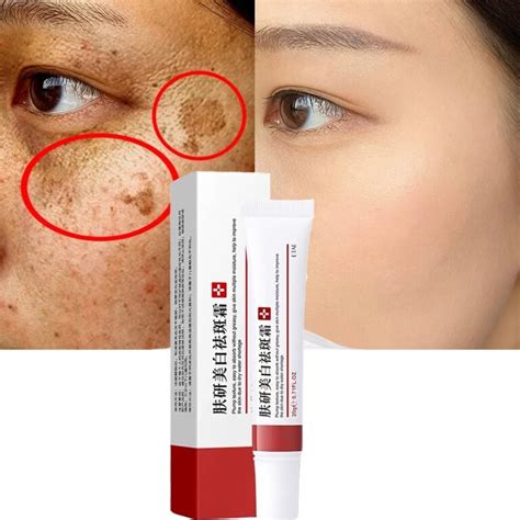 Dark Spots Removal Cream Effective Whitening Freckle Cream Remove