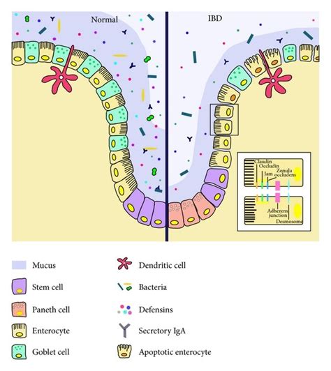 Components Of The Mucosal Barrier In Healthy Gut Left And