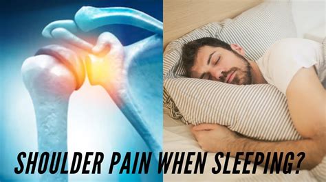 3 Tips For Those Who Have Shoulder Pain When Sleeping Youtube