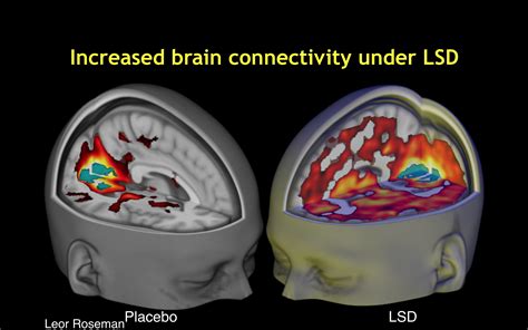 Scientists Reveal Worlds First Images Of The Human Brain On Lsd