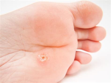 Common Foot Problems You Should Not Take Lightly
