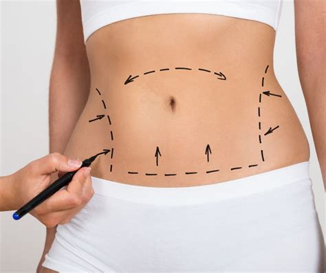 With aging, many people experience edema (excess fluid buildup in the tissues) after long flights. How to Reduce Swelling After Surgery - Tummy Tuck Supplies