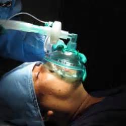 General anesthesia. Causes, symptoms, treatment General anesthesia