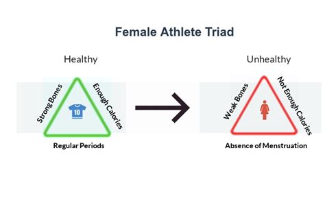 Female Athlete Triad Treatment