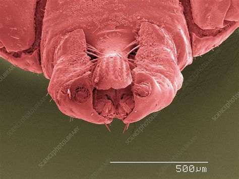 Coloured Sem Of Ticks Mouthparts Stock Image F0102971 Science