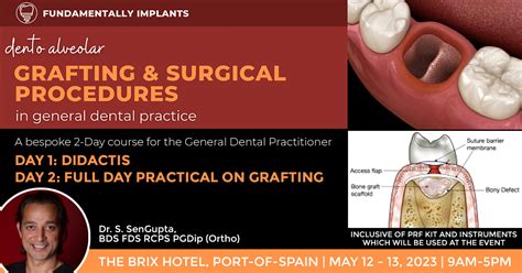 Grafting And Surgical Procedures In General Dental Practice 2 Day