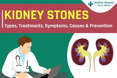 Kidney Stones Explained Types Treatments Symptoms Causes