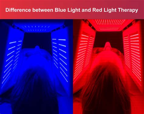 How Long Does It Take For Blue Light Therapy To Work Quora