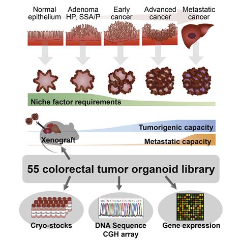 A Colorectal Tumor Organoid Library Demonstrates Progressive Loss Of