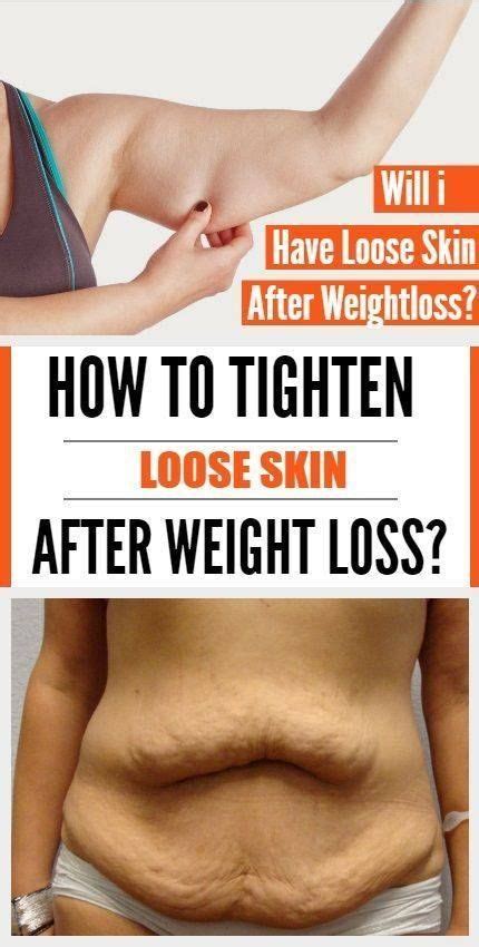 How To Tighten Loose Skin And Sagging Skin Tighten Loose Skin