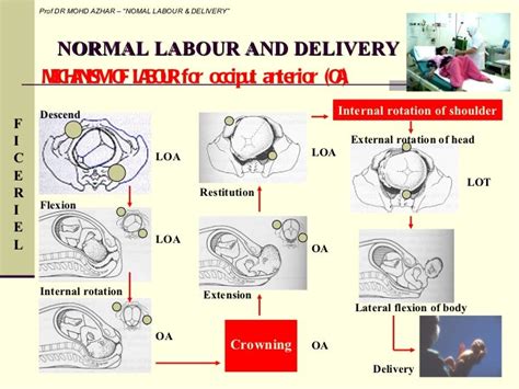 4 Normal Labour And Delivery