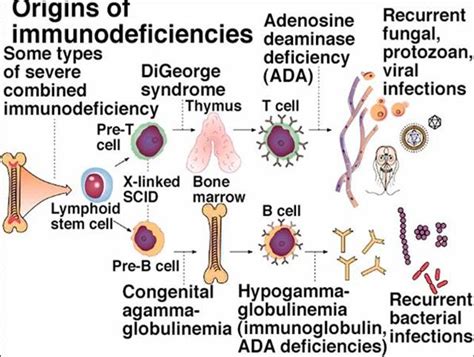 Bruton Agammaglobulinemia Immunology Medbullets Step 1