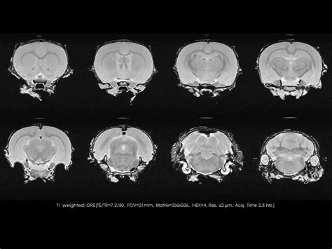 Ex Vivo Histology Normal Mouse Brain Aspect Imaging