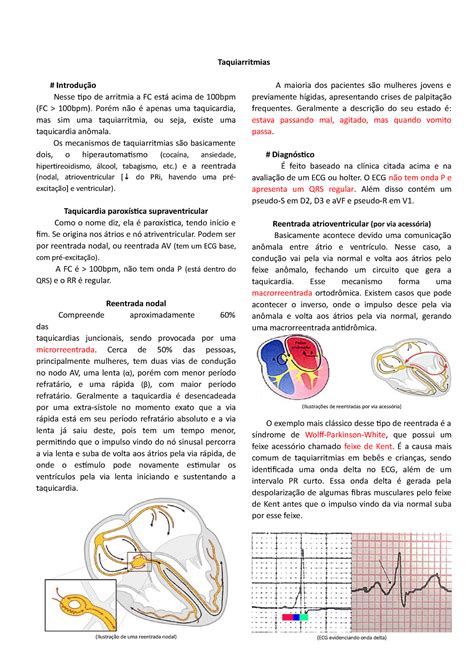 Taquiarritmias Resumo Sobre Matéria De Cardiologia E