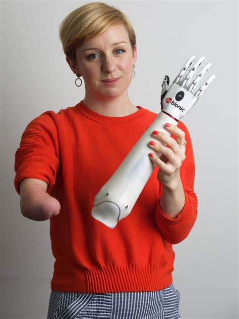 Revolutionary £1m Bionic Hand Allows One Armed Woman To Perform Everyday Tasks Mirror Online