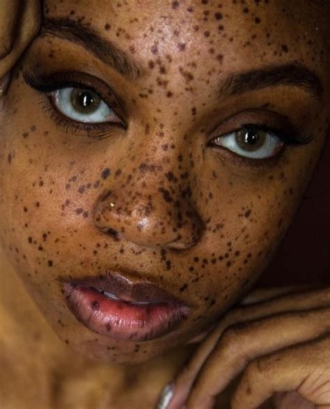 99 Tumblr Black Girls With Freckles Women With Freckles Freckles