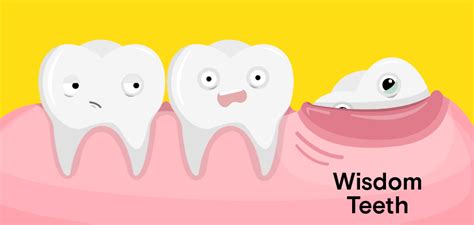 Wisdom Tooth Extraction Cost Procedure And Symptoms
