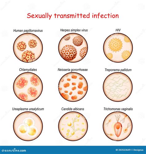 Sexually Transmitted Infection Close Up Of Causative Agents Of Venereal Disease Stock Vector