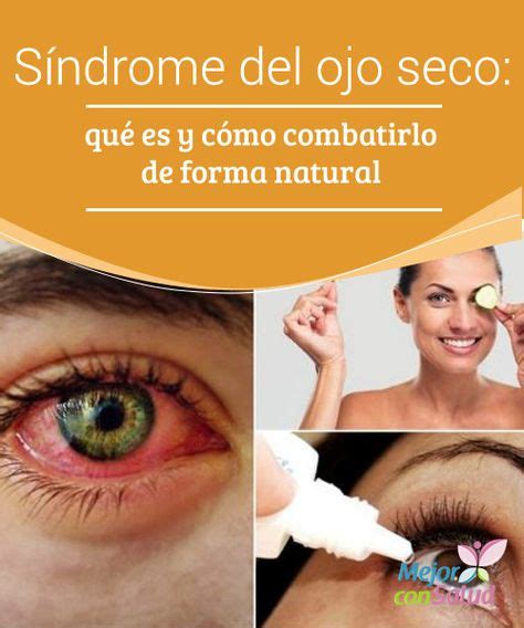 remedios caseros y naturales para los ojos secos e irritados con imágenes enfermedades del