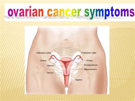 A cancerous (malignant) tumour starts from one abnormal cell. Ovarian Cancer Symptoms Stories - YouTube