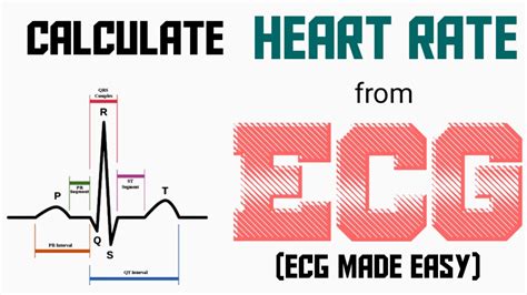 Calculation Of Heart Rate From Ecg Ecg Made Easy Ecg Lecture Part