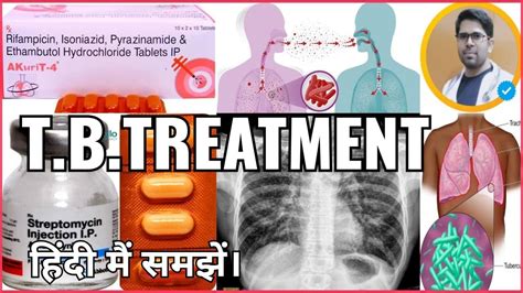 Tb Tuberculosis का कारण लक्षण इलाज Tb Treatment Tb मैं यूज होने वाली दवाईयां Akt 4 Tablets Use