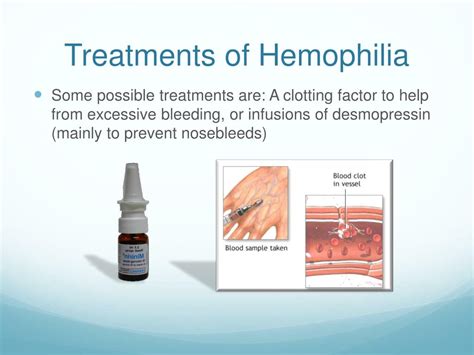 Ppt Hemophilia Powerpoint Presentation Free Download Id6496842