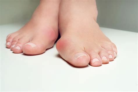 Types Of Foot Deformities Joint Replacement Institute