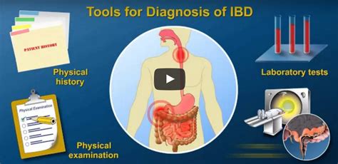 Diagnosing Ibd Inflammatory Bowel Disease Inflammatory Bowel
