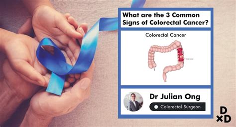 3 Common Signs Of Colorectal Cancer Human
