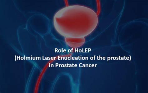 Holep Treatment In India For Prostate Cancer Hospitals Hbg