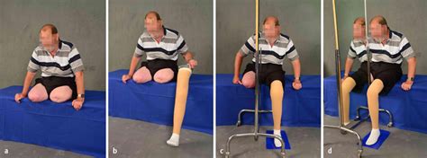 Spiegeltherapie Zur Behandlung Von Phantomschmerzen Nach Beidseitiger