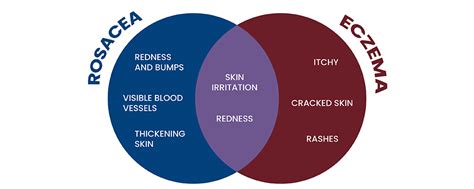 Rosacea Vs Eczema How To Tell The Difference