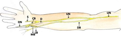 High Origin Of Dorsal Branch Of The Ulnar Nerve And Variations In Its