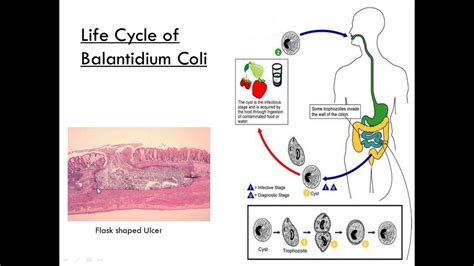Balantidium Coli Class Ciliate Parasitology Youtube