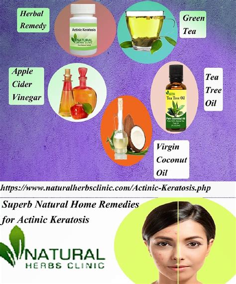Natural Herbs Clinic Natural Remedies For Actinic Keratosis Modern