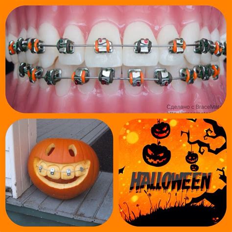 Get Ready For Halloween Orthodontics Braces Brackets Ortodoncia Braceslife Pumpkin