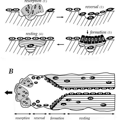 A Schematic Of Remodelling Sequence On A Trabecular Cancellous Bone