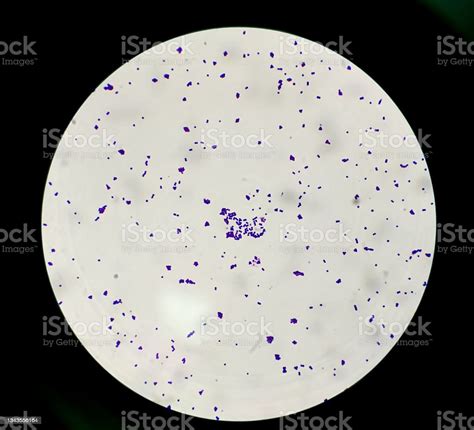 Colonies Gram Stain Under 100x Light Microscope Show Gram Positive