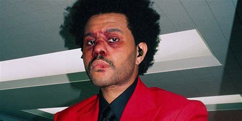 The Weeknd розповів чому виступає у повязках на обличчі Nv