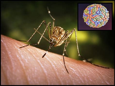 Explained What Is West Nile Virus All About Symptoms Diagnosis