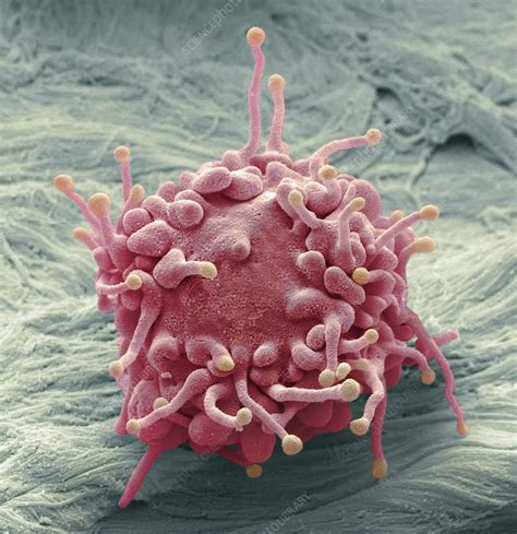 Lymphoma Cancer Cell Sem Stock Image C0230870 Science Photo Library