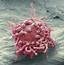 Lymphoma Cancer Cell SEM  Stock Image C023/0870 Science Photo Library