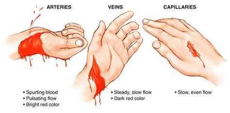 First Aid Steps For Severe Bleeding Free Cpr Training