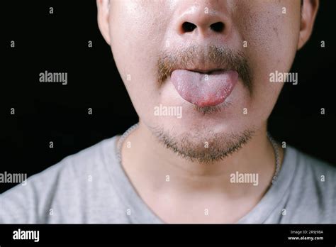 A Close Up Shot Of A Partial Face Of A Young Asian Man With The Tongue